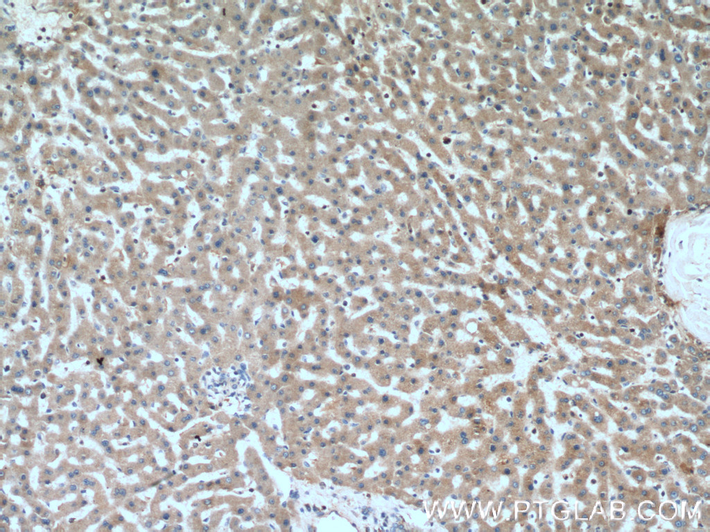 IHC staining of human liver using 15837-1-AP