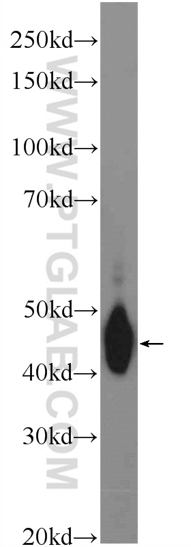 WB analysis of human plasma using 15837-1-AP