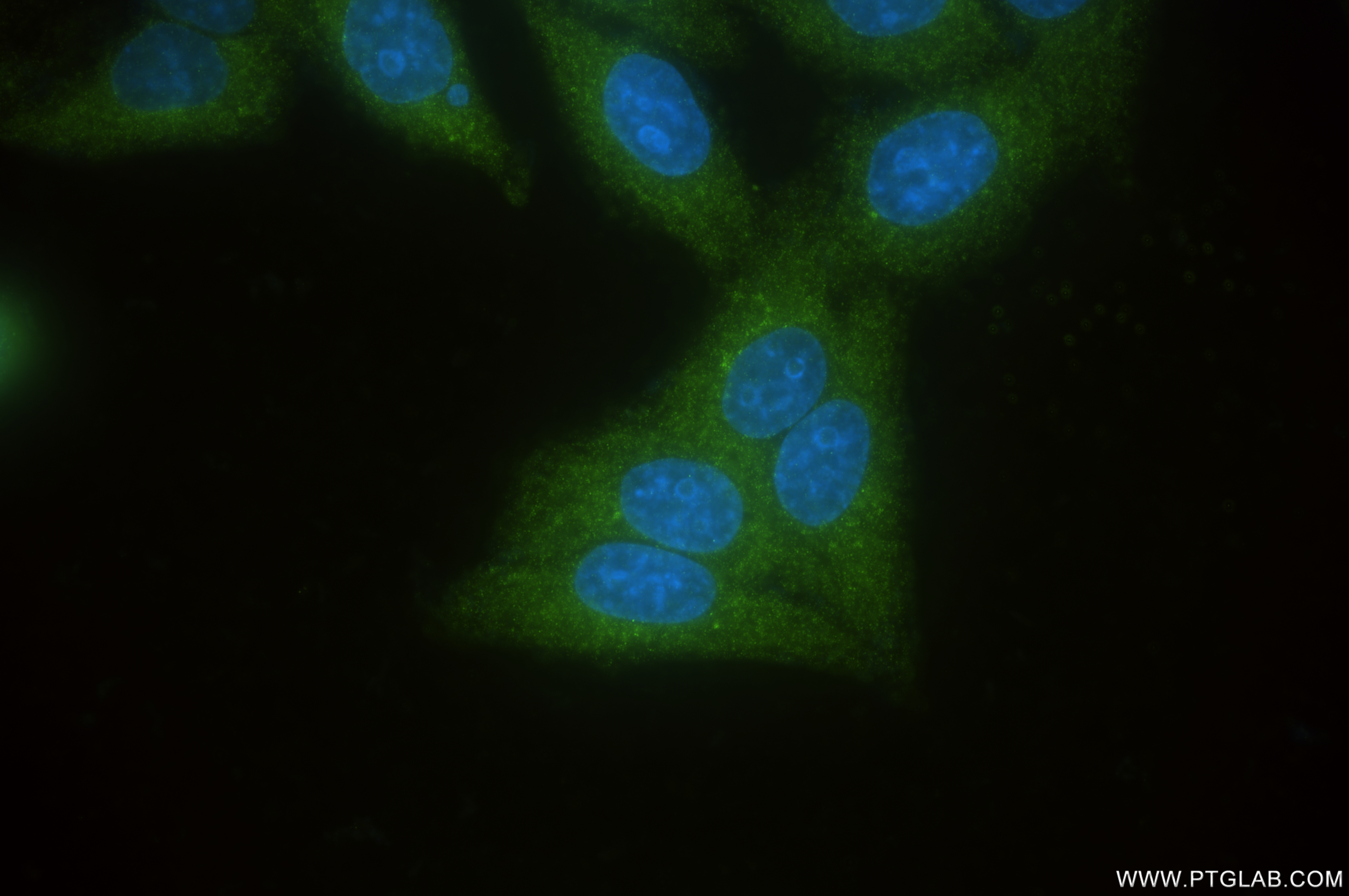 IF Staining of HepG2 using 85782-2-RR (same clone as 85782-2-PBS) IF Staining of HepG2 using 85782-2-RR (same clone as 85782-2-PBS)
