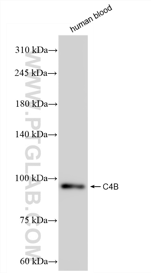 WB analysis of human blood using 85782-2-RR (same clone as 85782-2-PBS) WB analysis of human blood using 85782-2-RR (same clone as 85782-2-PBS)