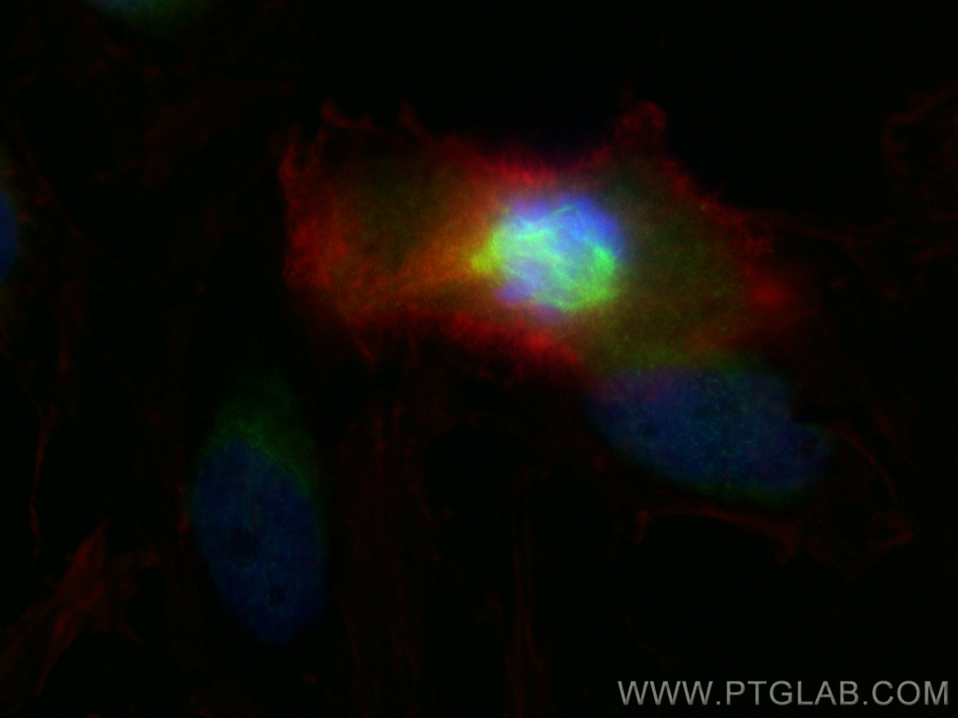 Immunofluorescent analysis of (4% PFA) fixed HeLa cells using HAUS3 antibody (18991-1-AP) at dilution of 1:200 and CoraLite®488-Conjugated Goat Anti-Rabbit IgG(H+L) (<a class='green' href='/productredirect?CatalogNo=SA00013-2' target='_blank'>SA00013-2</a>), CL594-phalloidin (red). IF Staining of HeLa using 18991-1-AP