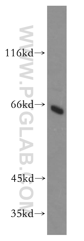 WB analysis of HepG2 using 18991-1-AP