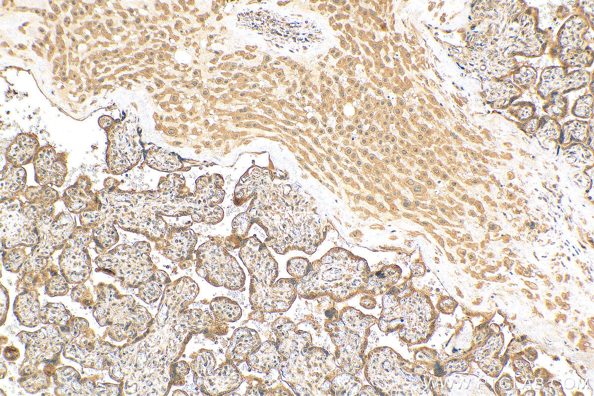 IHC staining of human placenta using 30132-1-AP