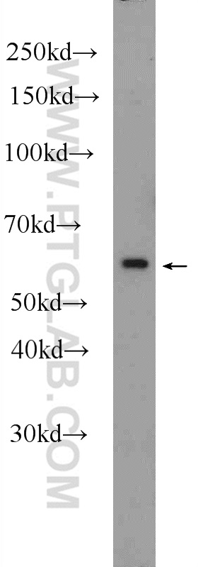 WB analysis of PC-3 using 25036-1-AP