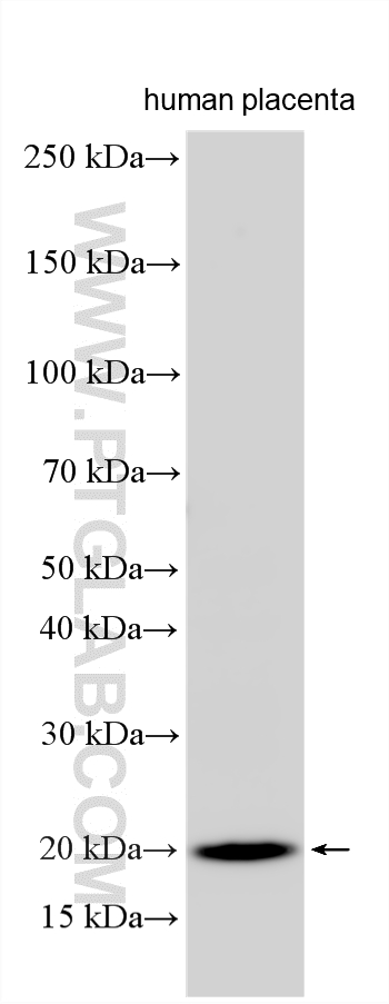 WB analysis using 33453-1-AP (same clone as 33453-1-PBS) WB analysis using 33453-1-AP (same clone as 33453-1-PBS)