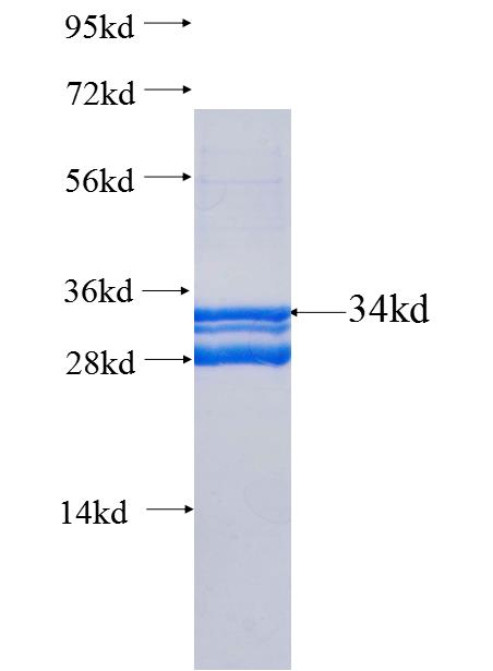 C5, C5a fusion protein Ag25581 SDS-PAGE