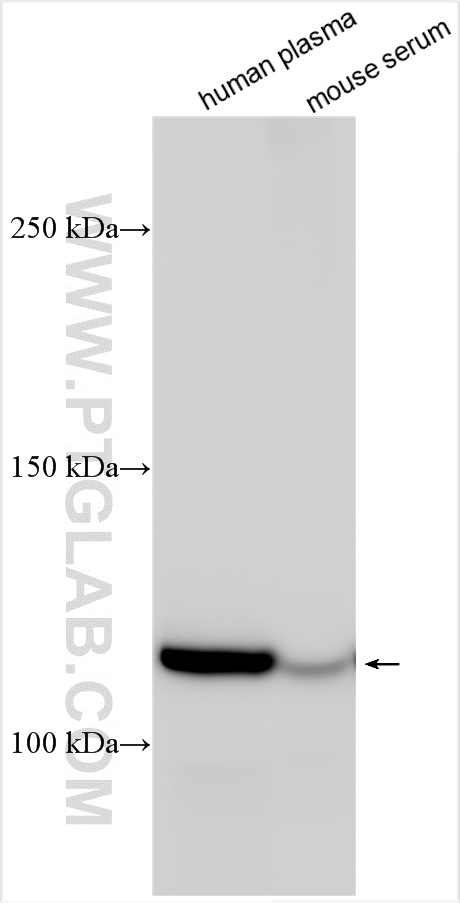 WB analysis using 22492-1-AP