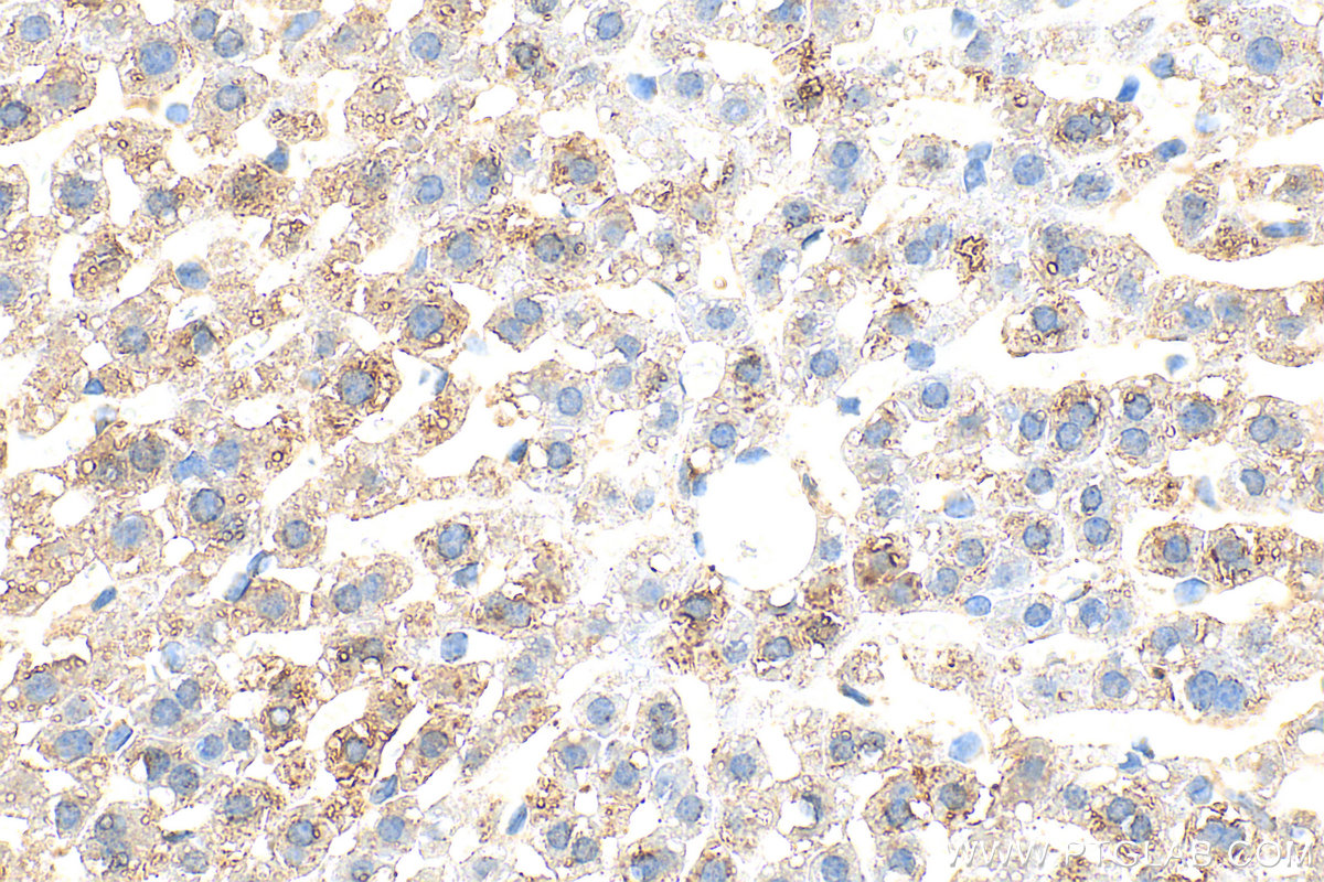 IHC staining of mouse liver using 32767-1-AP
