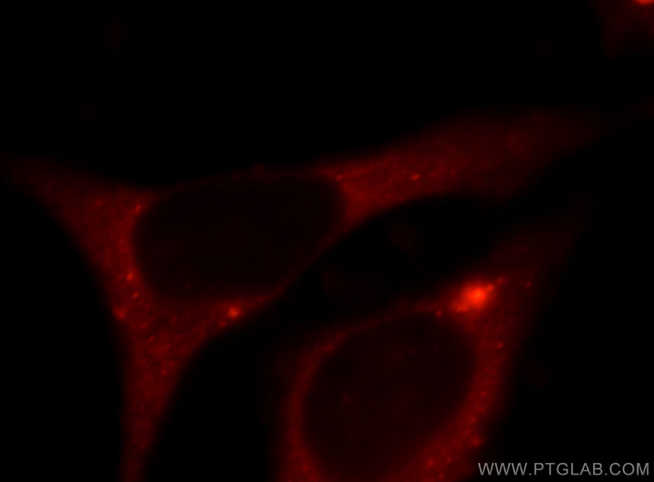 IF Staining of HepG2 using 21316-1-AP