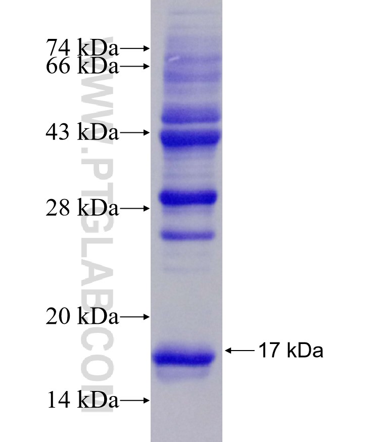 C5AR1 fusion protein Ag29170 SDS-PAGE