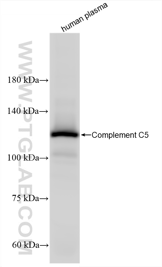 WB analysis of human plasma using 86463-4-RR (same clone as 86463-4-PBS) WB analysis of human plasma using 86463-4-RR (same clone as 86463-4-PBS)