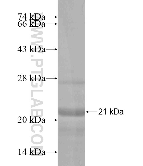 C5orf24 fusion protein Ag19660 SDS-PAGE C5orf24 fusion protein Ag19660 SDS-PAGE