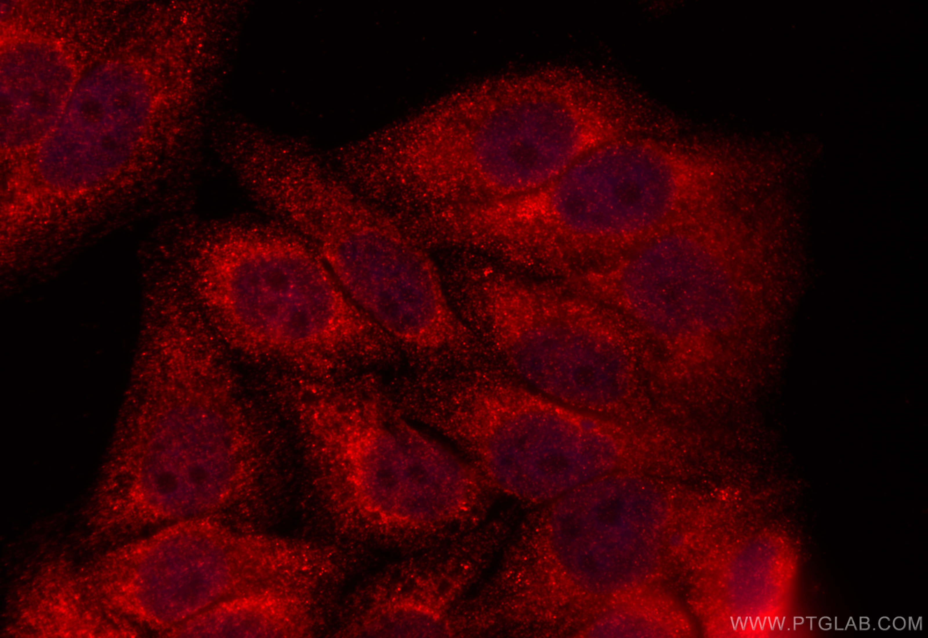 IF Staining of HepG2 using 24698-1-AP