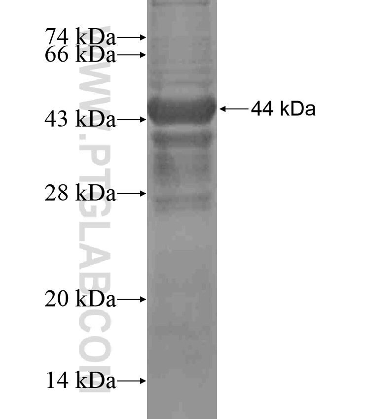 C5orf37 fusion protein Ag17060 SDS-PAGE C5orf37 fusion protein Ag17060 SDS-PAGE