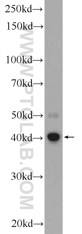 WB analysis of COLO 320 using 22046-1-AP