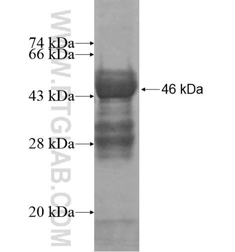 C5orf45 fusion protein Ag14256 SDS-PAGE C5orf45 fusion protein Ag14256 SDS-PAGE