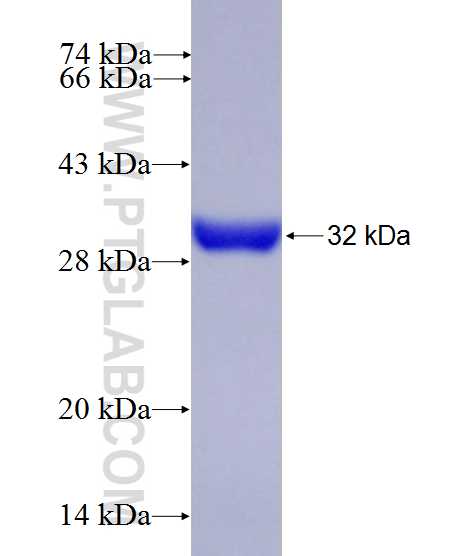 C5orf46 fusion protein Ag27263 SDS-PAGE C5orf46 fusion protein Ag27263 SDS-PAGE