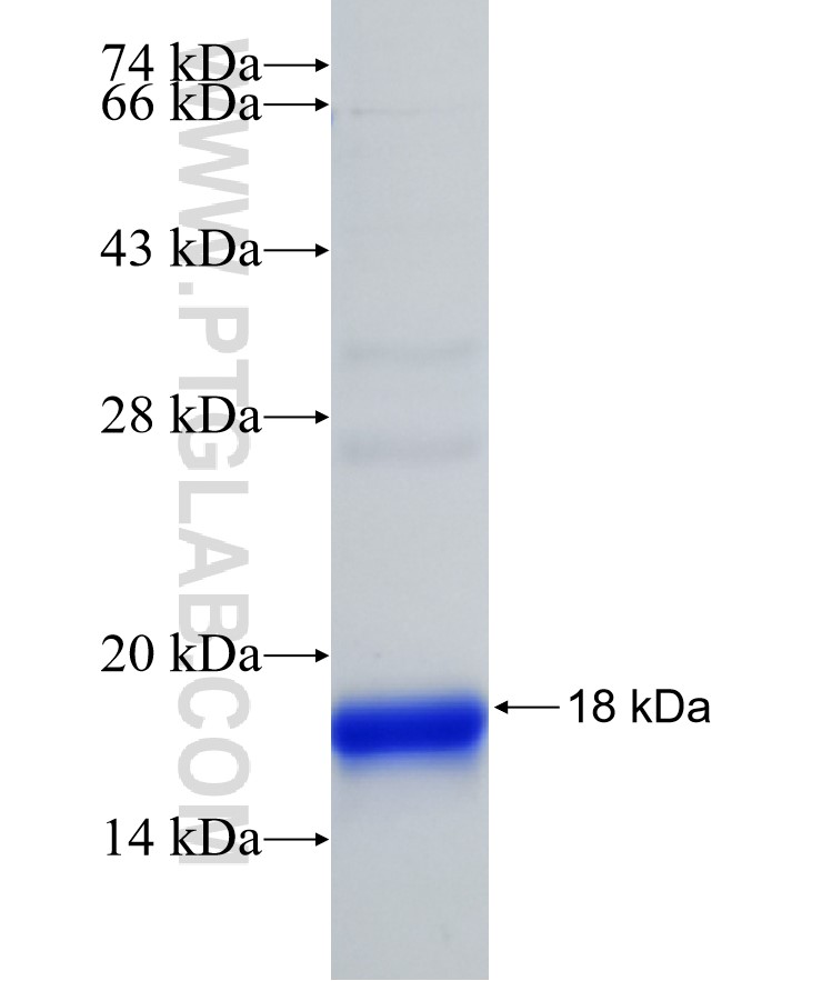 C5orf51 fusion protein Ag32413 SDS-PAGE C5orf51 fusion protein Ag32413 SDS-PAGE