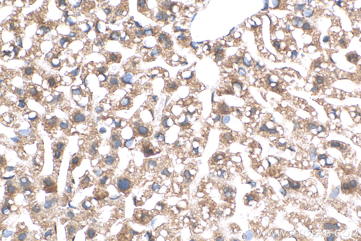 IHC staining of mouse liver using 17239-1-AP