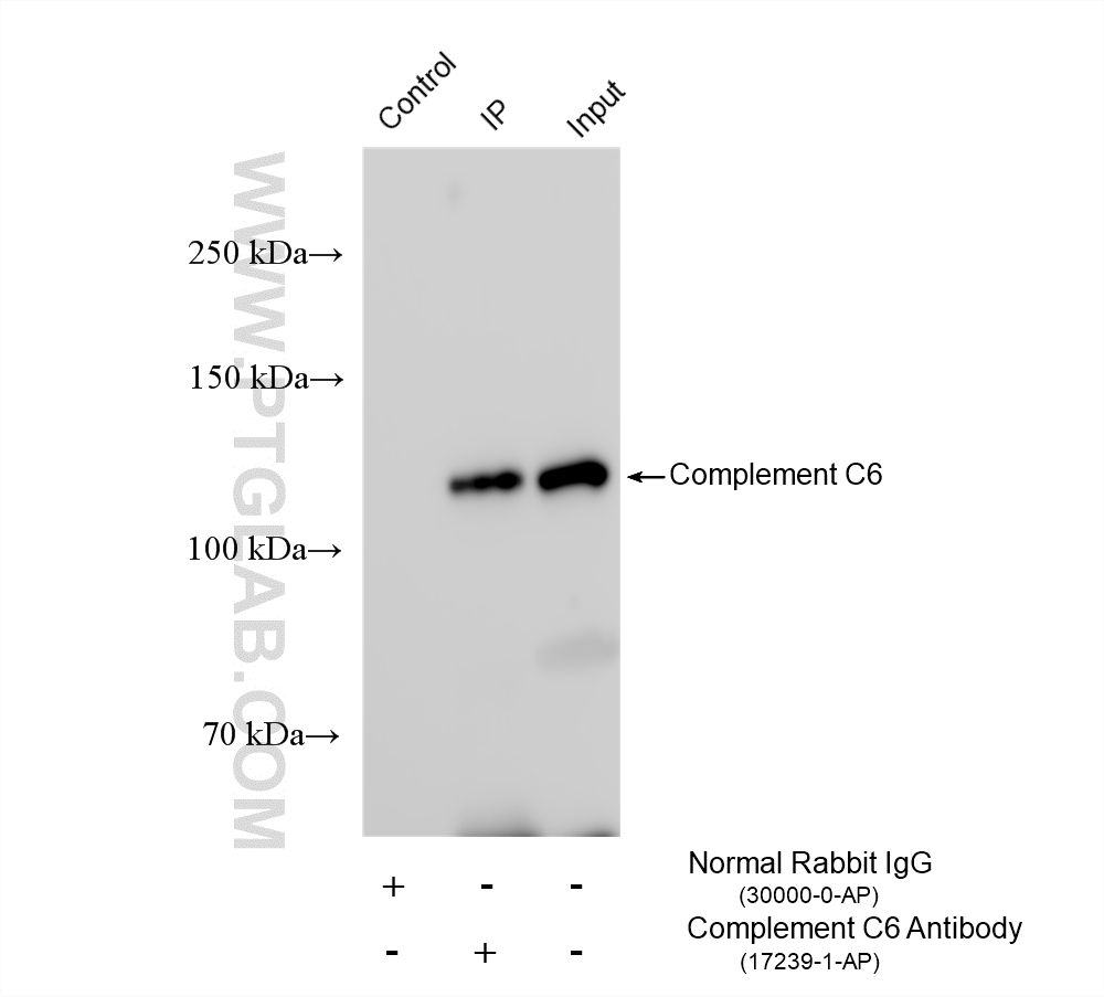 IP result of anti-Complement C6 (IP:17239-1-AP, 4ug; Detection:17239-1-AP 1:3000) with human plasma  lysate 3200 ug. IP experiment of human plasma using 17239-1-AP