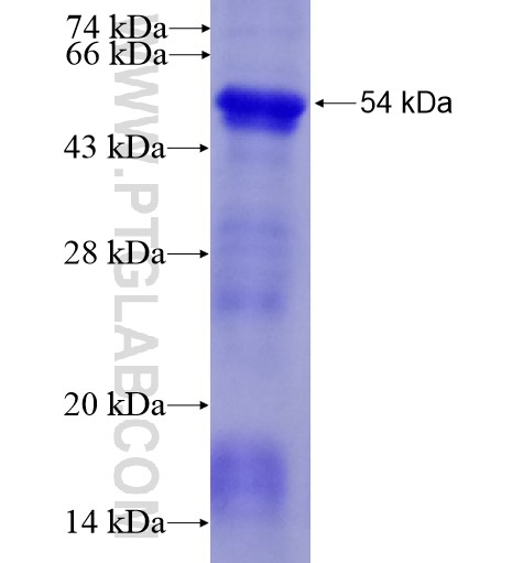 C6 fusion protein Ag11107 SDS-PAGE C6 fusion protein Ag11107 SDS-PAGE