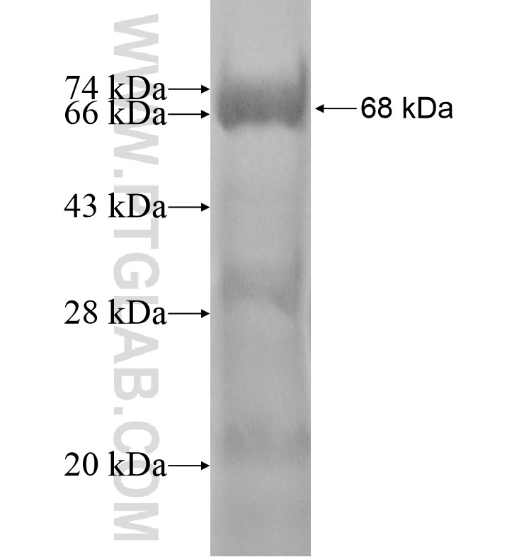 C6orf10 fusion protein Ag16194 SDS-PAGE C6orf10 fusion protein Ag16194 SDS-PAGE