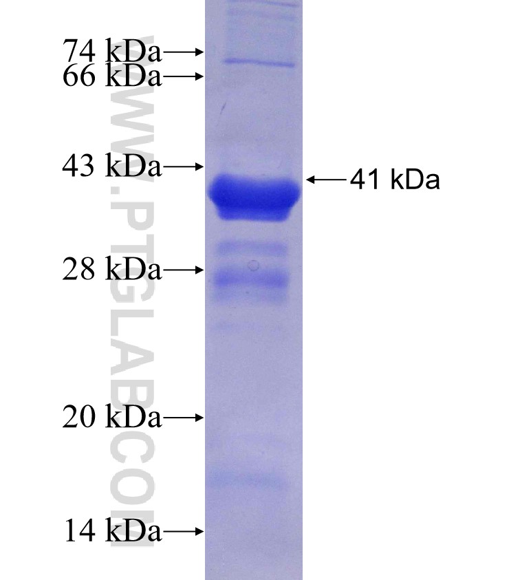C6orf106 fusion protein Ag30012 SDS-PAGE
