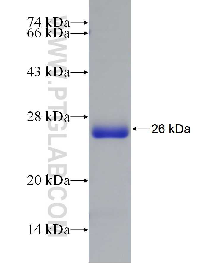 C6orf108 fusion protein Ag22382 SDS-PAGE