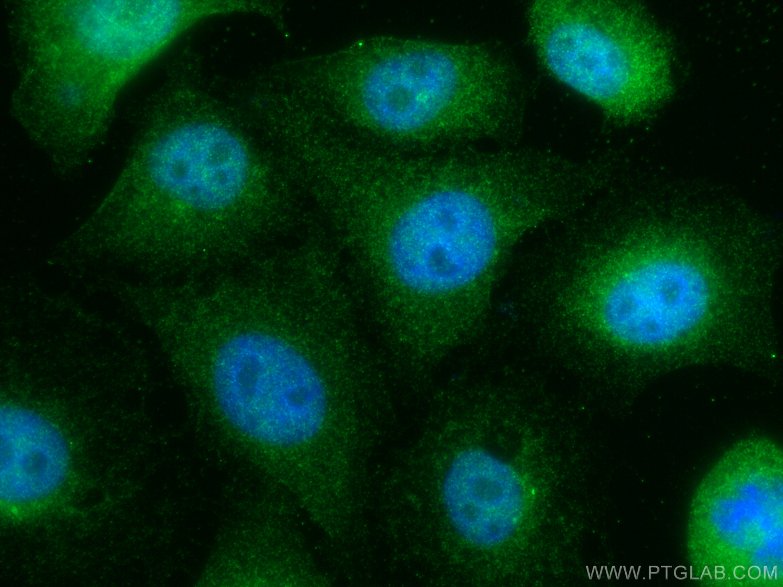 IF Staining of A549 using 28828-1-AP (same clone as 28828-1-PBS)