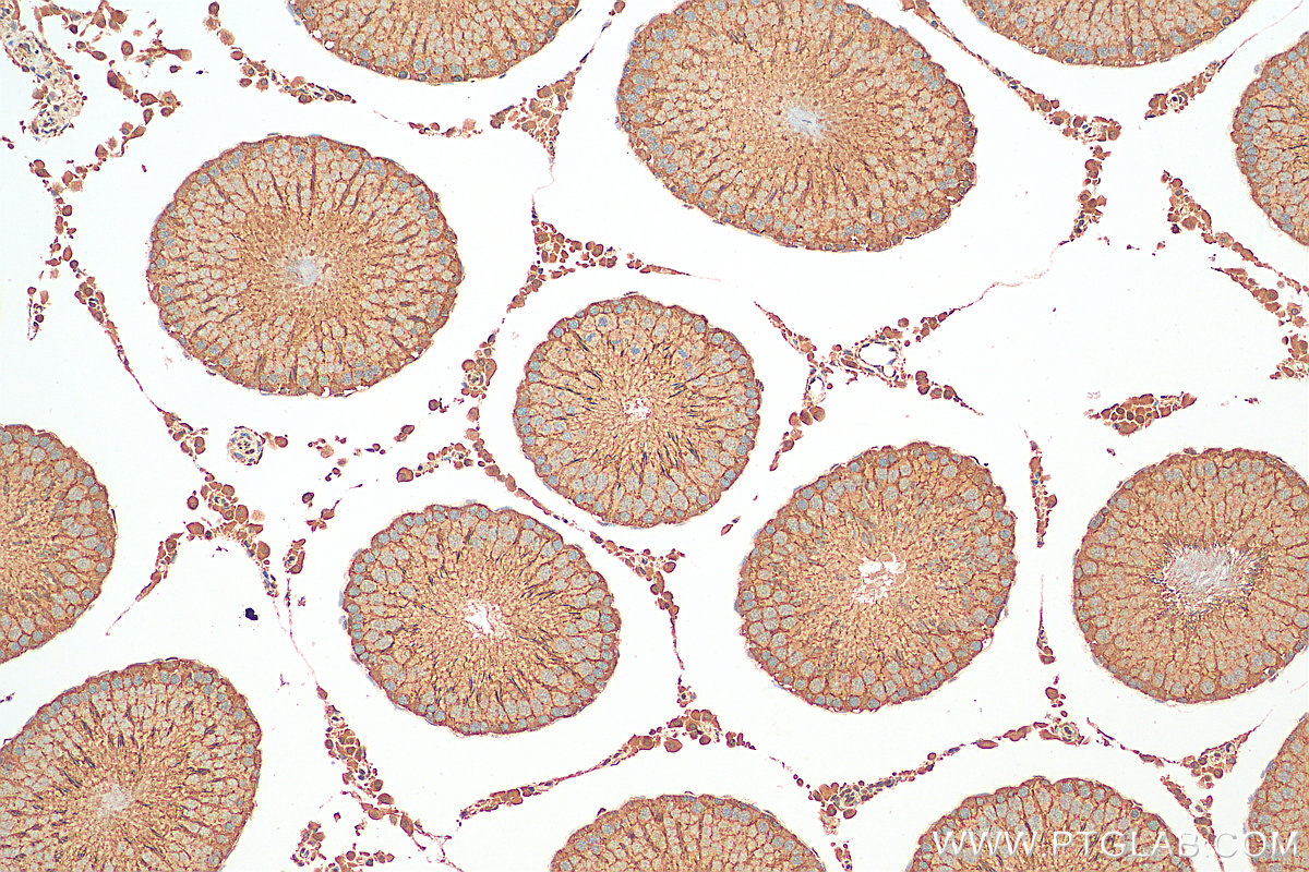 IHC staining of rat testis using 28828-1-AP (same clone as 28828-1-PBS)