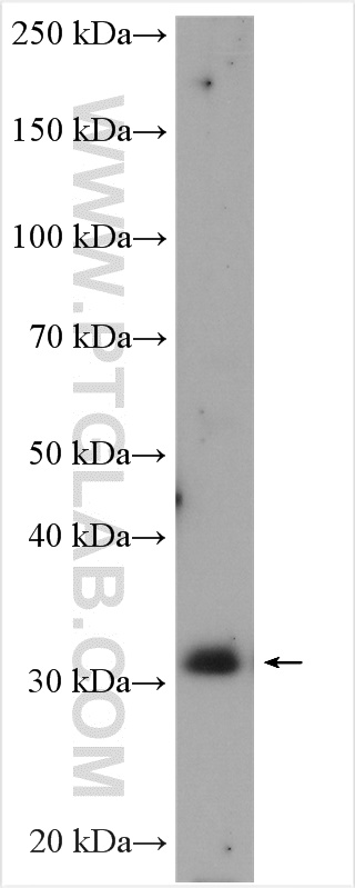 WB analysis of A431 using 24355-1-AP