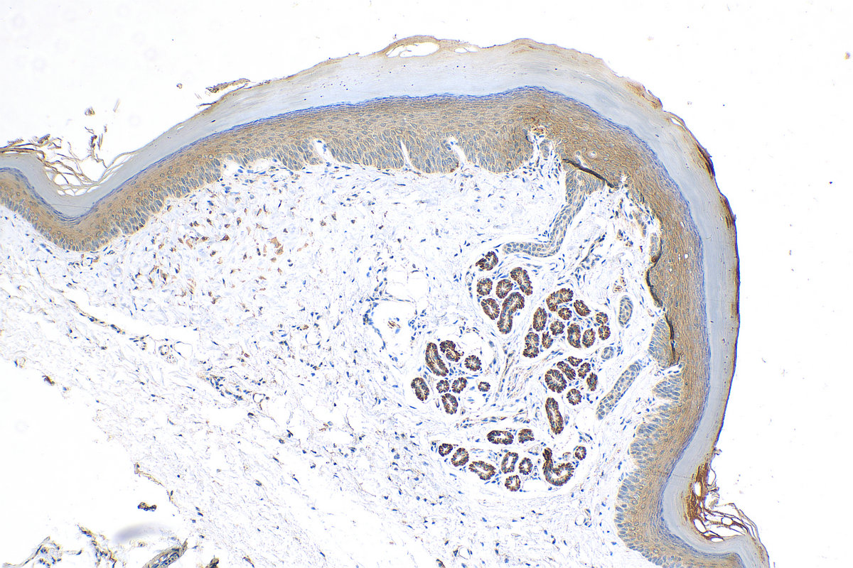 IHC staining of mouse skin using 24953-1-AP