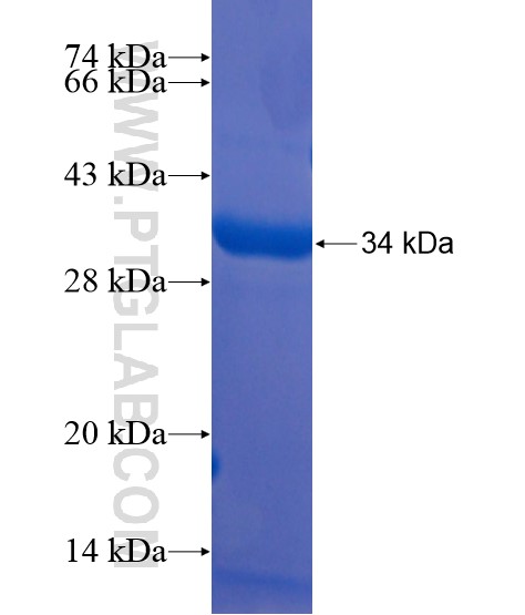 C6orf185 fusion protein Ag21675 SDS-PAGE C6orf185 fusion protein Ag21675 SDS-PAGE
