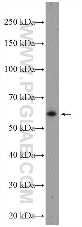 WB analysis of PC-13 using 24588-1-AP