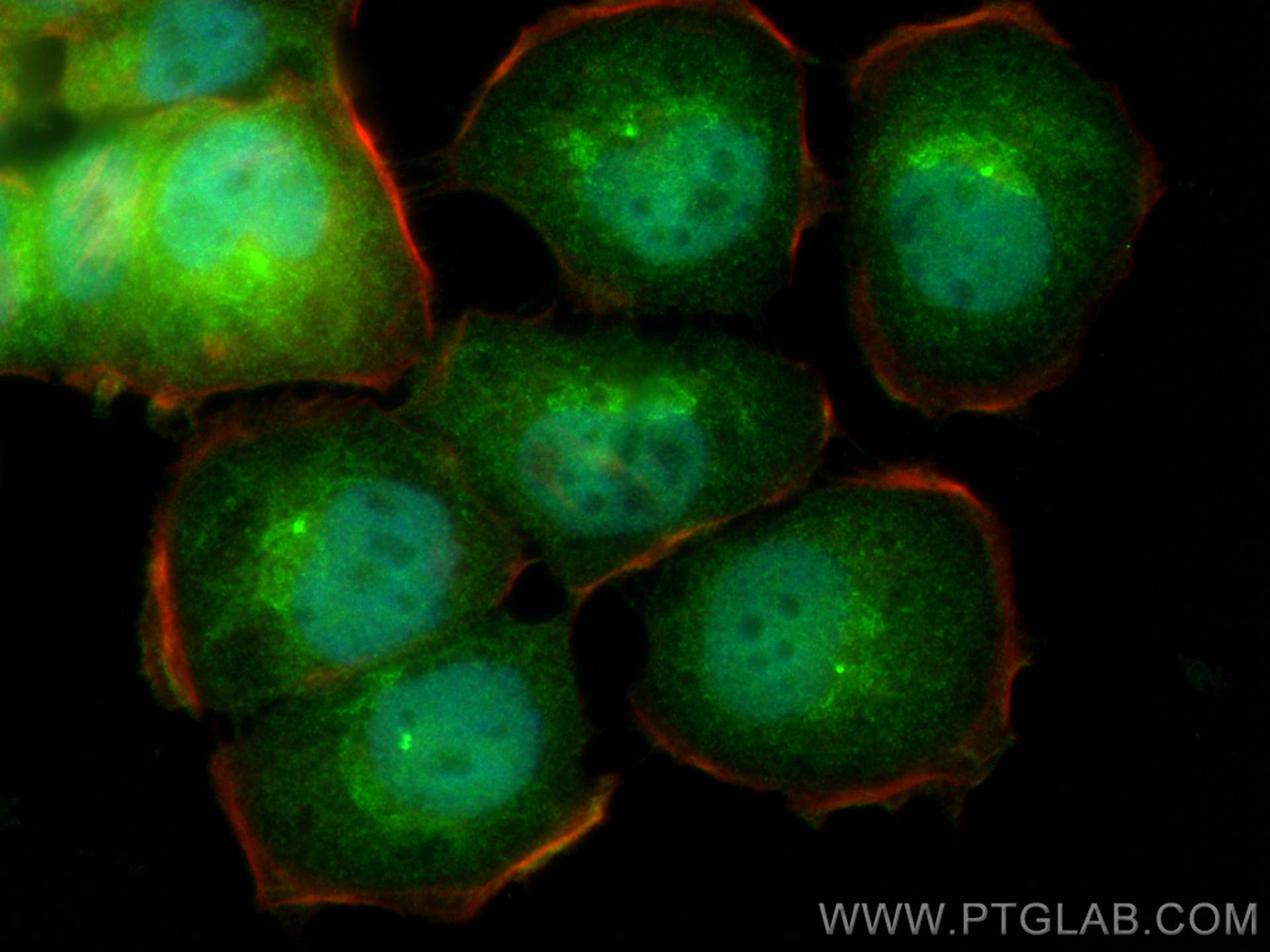 IF Staining of T-47D using 25124-1-AP