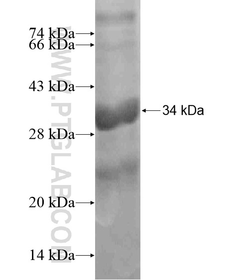 C6orf218 fusion protein Ag19529 SDS-PAGE C6orf218 fusion protein Ag19529 SDS-PAGE