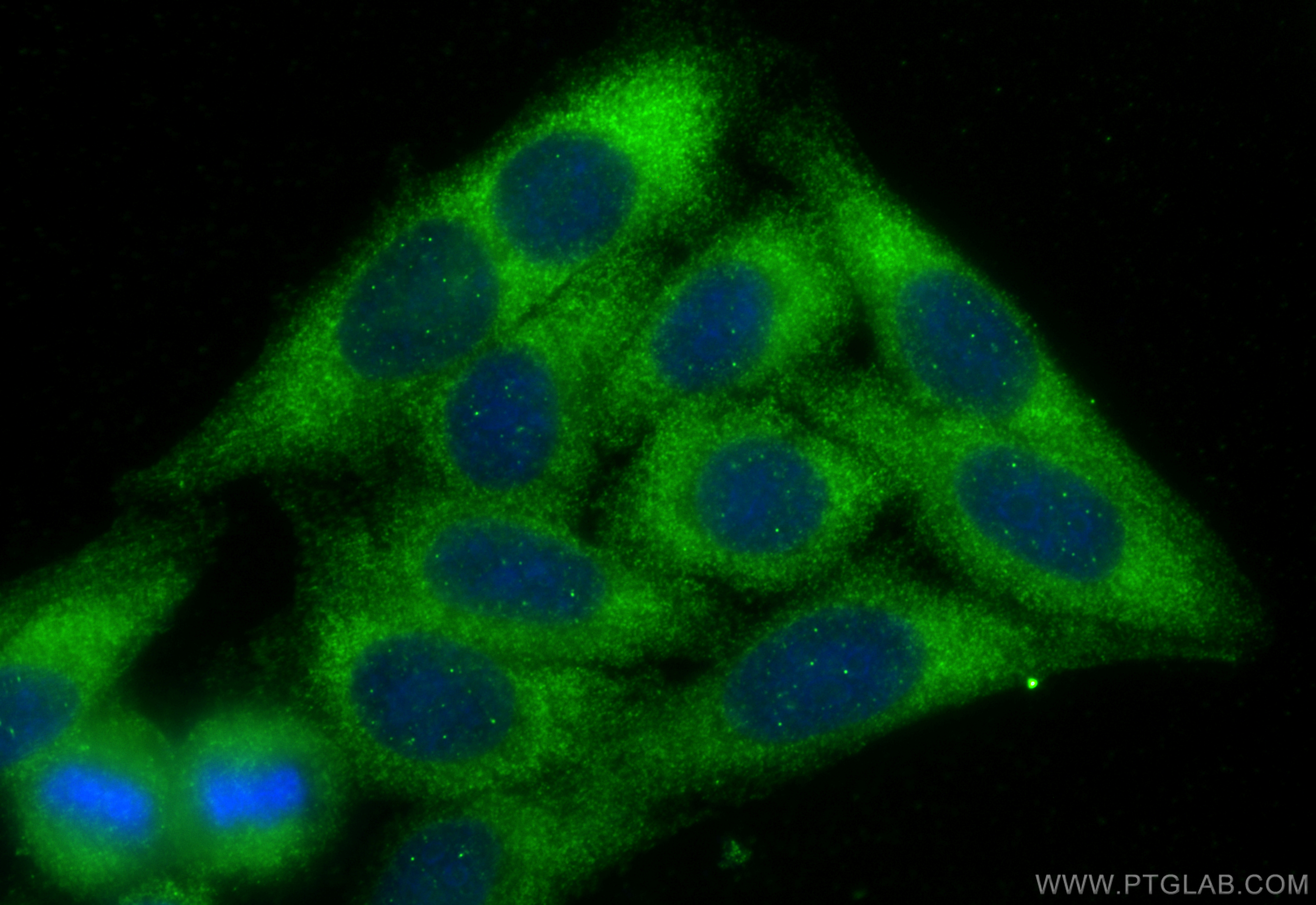 IF Staining of HepG2 using 24989-1-AP