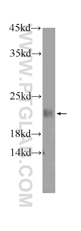 WB analysis of human testis using 24989-1-AP