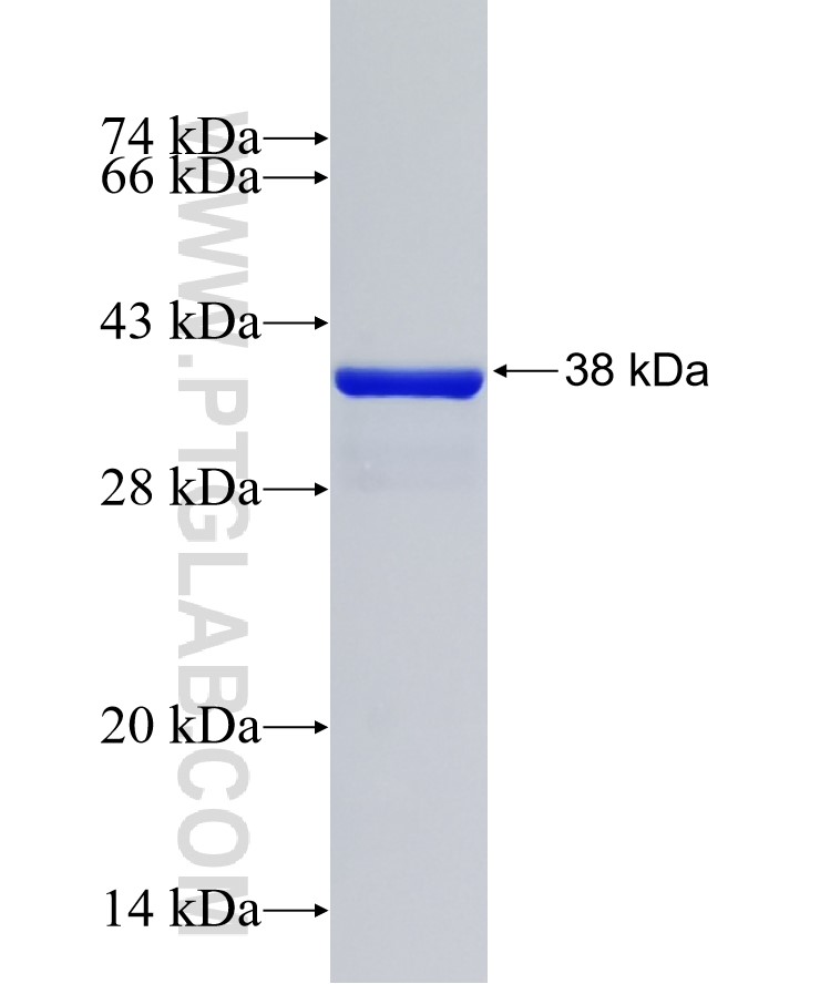 C6orf57 fusion protein Ag33549 SDS-PAGE