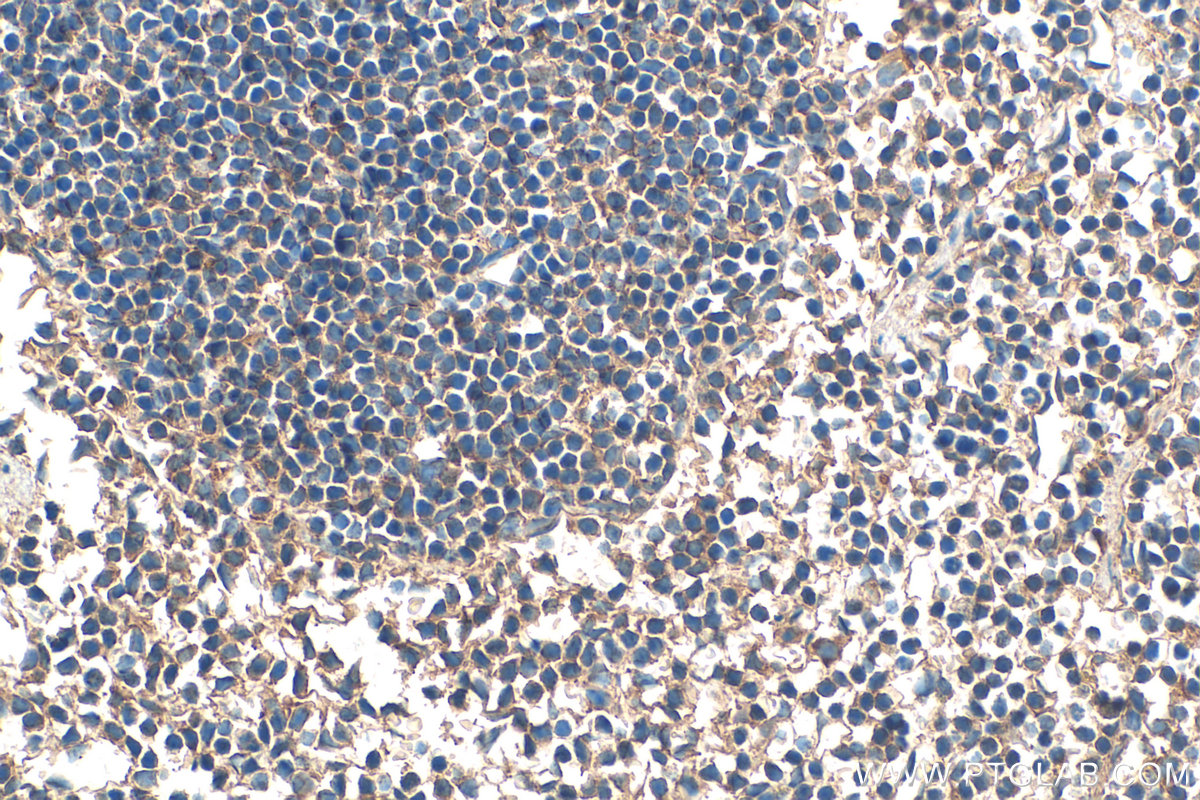 IHC staining of mouse spleen using 17642-1-AP