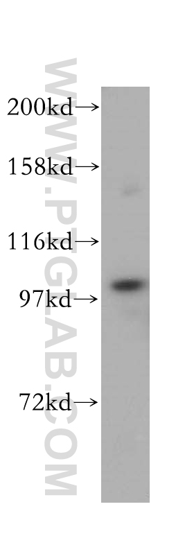 WB analysis of mouse thymus using 17642-1-AP