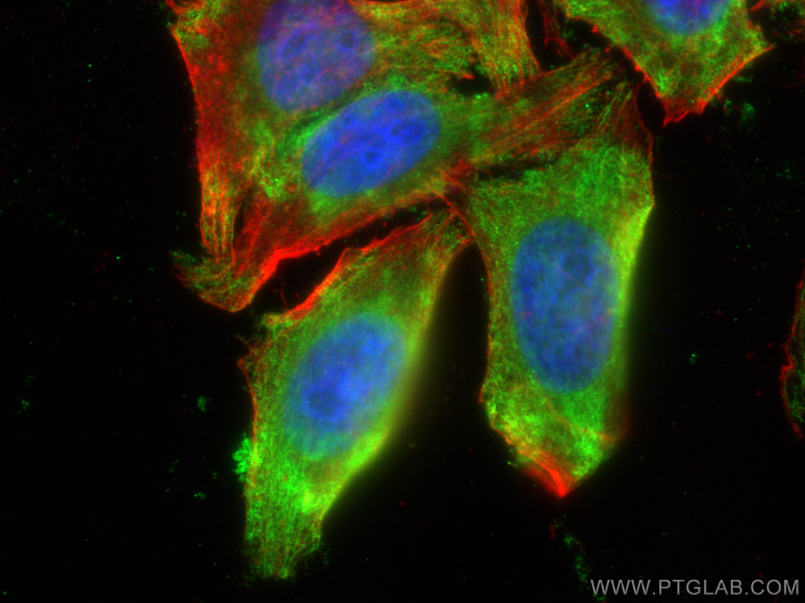 IF Staining of HepG2 using 66908-1-Ig (same clone as 66908-1-PBS)