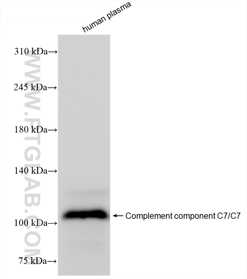 WB analysis of human plasma using 84263-5-RR (same clone as 84263-5-PBS)
