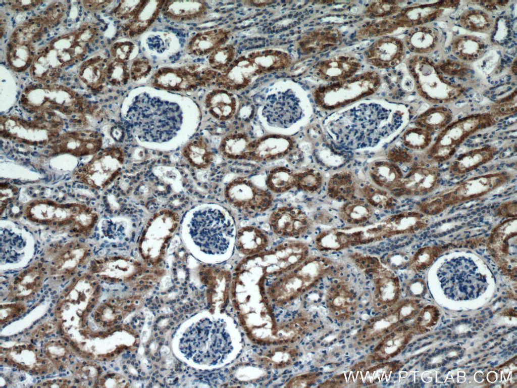 IHC staining of human kidney using 21589-1-AP