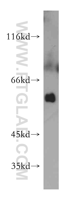 WB analysis of mouse skeletal muscle using 21589-1-AP