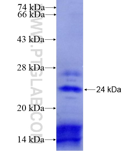 C7orf16 fusion protein Ag15620 SDS-PAGE