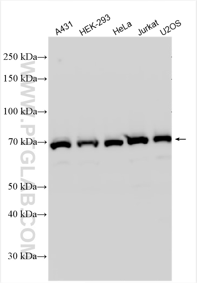 WB analysis using 31921-1-AP (same clone as 31921-1-PBS)