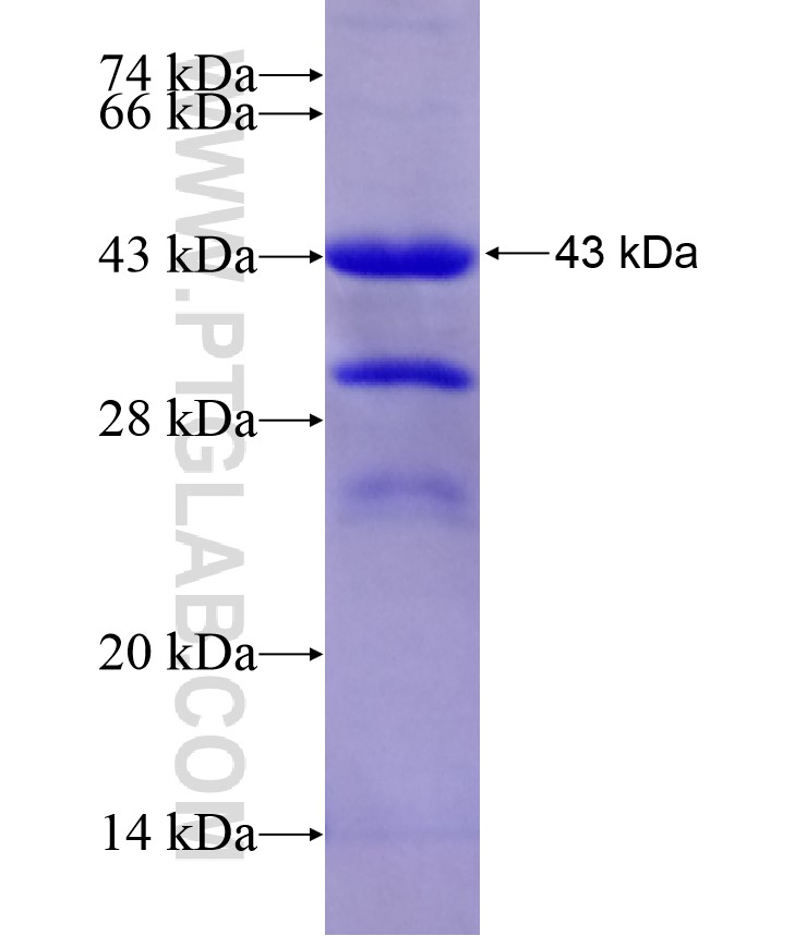C7orf28A fusion protein Ag17890 SDS-PAGE C7orf28A fusion protein Ag17890 SDS-PAGE