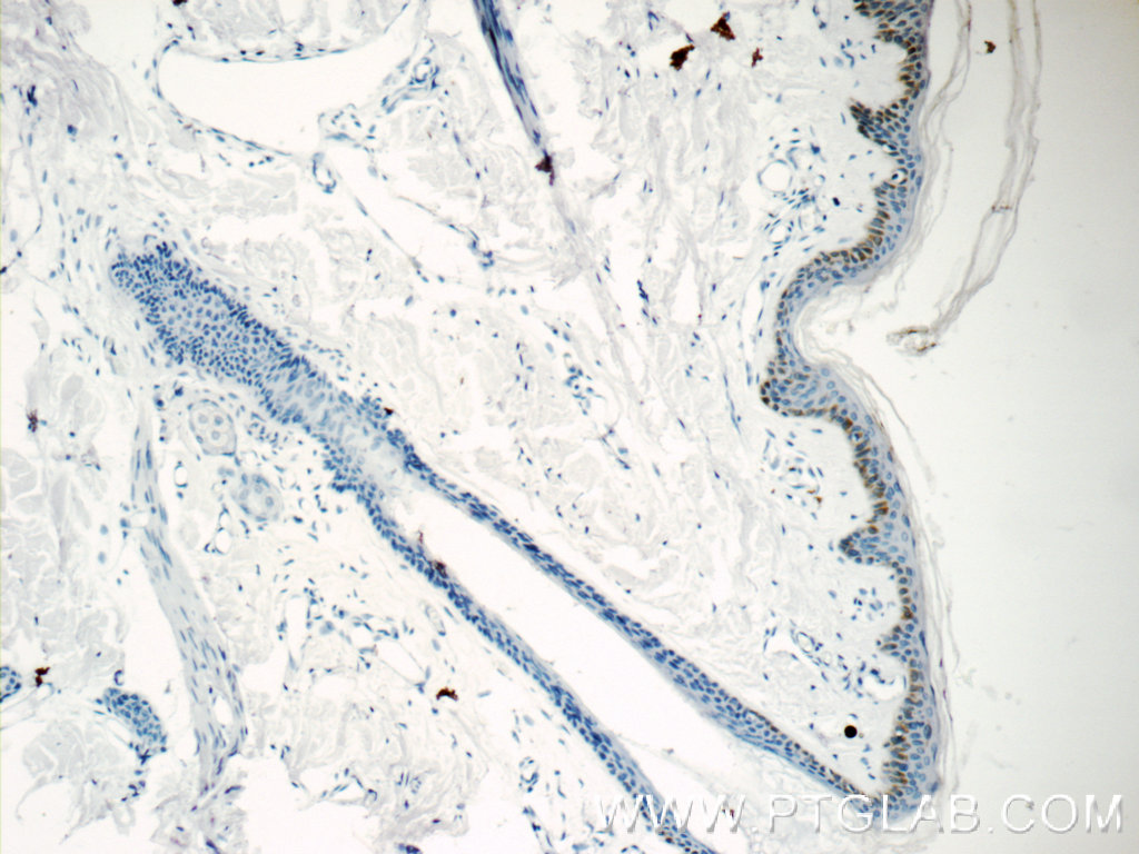 IHC staining of human skin using 15076-1-AP