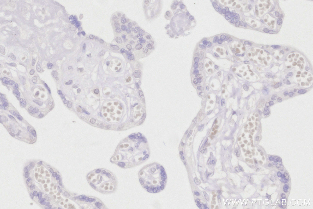 Immunohistochemical analysis of paraffin-embedded human placenta tissue slide using 15076-1-AP (C7orf49 antibody) at dilution of 1:200 (under 40x lens). Heat mediated antigen retrieval with Tris-EDTA buffer (pH 9.0). IHC staining of human placenta using 15076-1-AP